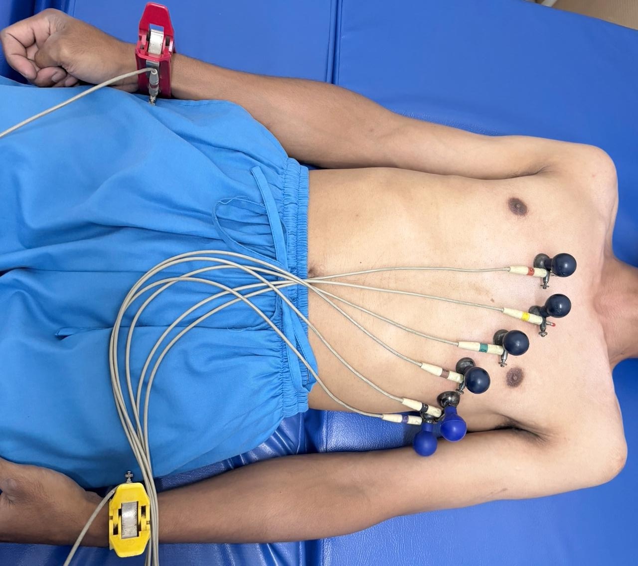 Pemeriksaan EKG Klinik Yope