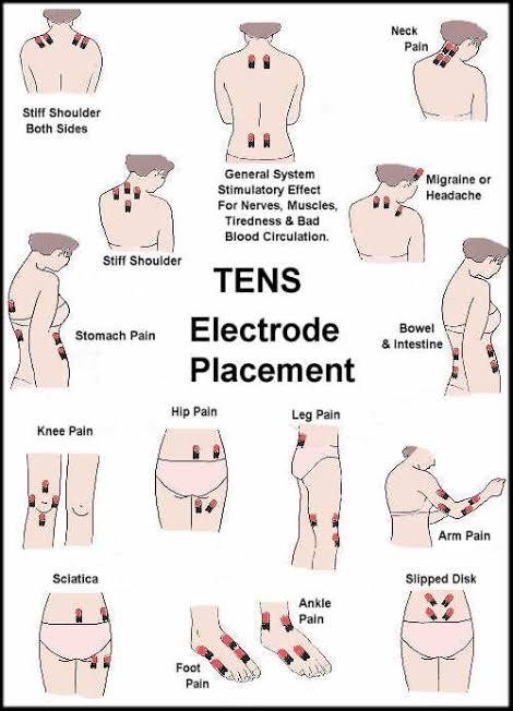Sesi terapi TENS di Klinik Yope